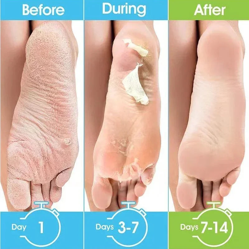 Honey Foot Mask